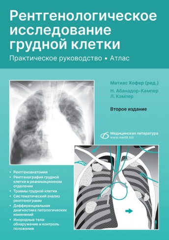 Рентгенологическое исследование грудной клетки. Практическое руководство. Атлас. 2-е издание, перераб. и доп.