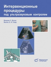 Интервенционные процедуры под ультразвуковым контролем