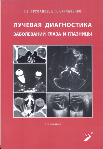 Лучевая диагностика заболеваний глаза и глазницы. Конспект лучевого диагноста. 3-изд