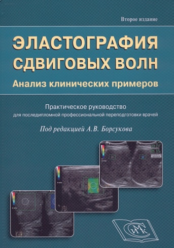 Эластография сдвиговых волн. Анализ клинических примеров. Практическое руководство для последипломной профессиональной переподготовки врачей
