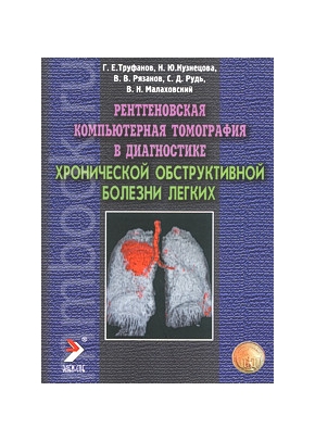 Рентгеновская компьютерная томография в диагностике хронической обструктивной болезни легких