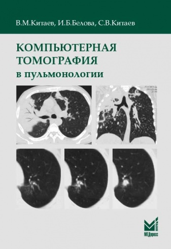 Компьютерная томография в пульмонологии