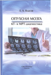 Опухоли мозга  КТ- и МРТ-диагностика