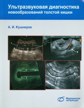 Ультразвуковая диагностика новообразований толстой кишки