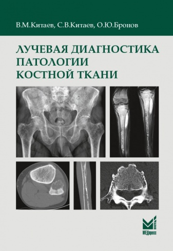 Лучевая диагностика патологии костной ткани