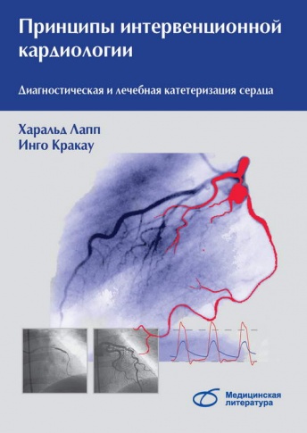Принципы интервенционной кардиологии. Диагностическая и лечебная катетеризация сердца
