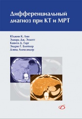 Дифференциальный диагноз при КТ и МРТ